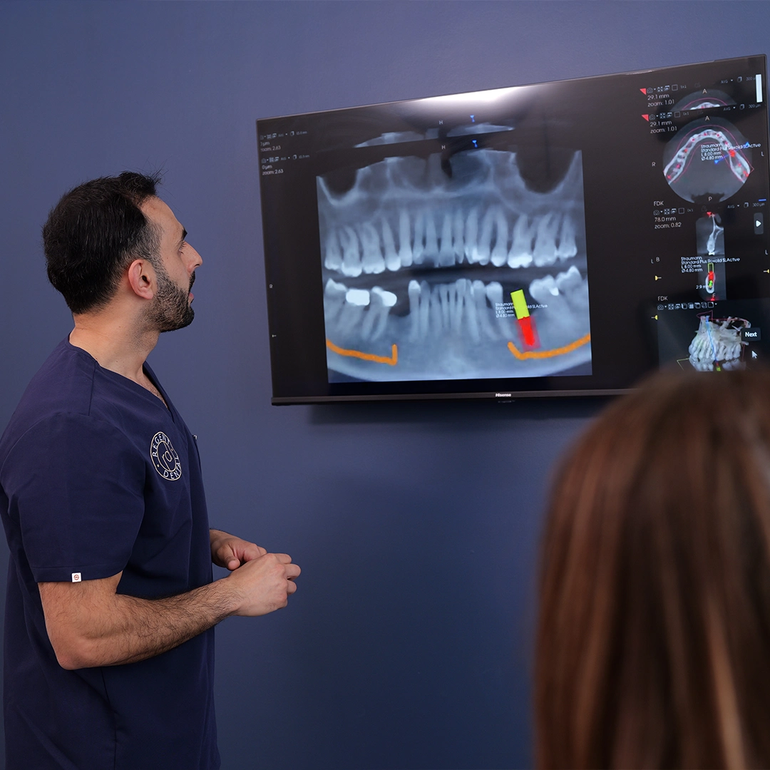 Good Candidate for Dental Implants